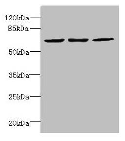 Western blot. All lanes: INTS11 antibody at 2µg/ml. Lane 1: Colo320 whole cell lysate. Lane 2: Hela whole cell lysate. Lane 3: MCF-7 whole cell lysate. Secondary. Goat polyclonal to Rabbit IgG at 1/10000 dilution. Predicted band size: 68, 57, 66, 65, 69 kDa. Observed band size: 68 kDa
