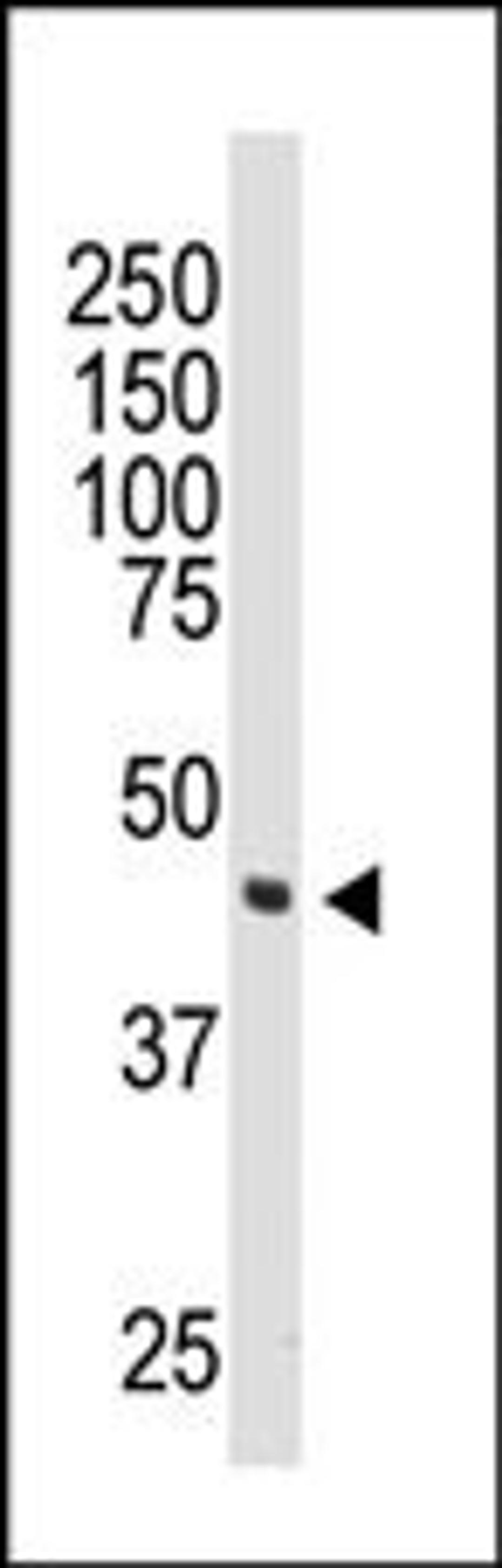 Western blot analysis of anti-DOK2 Pab in 174xCEM cell lysate