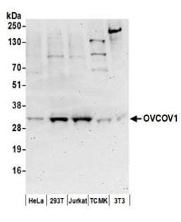 Detection of human and mouse OVCOV1 by western blot.