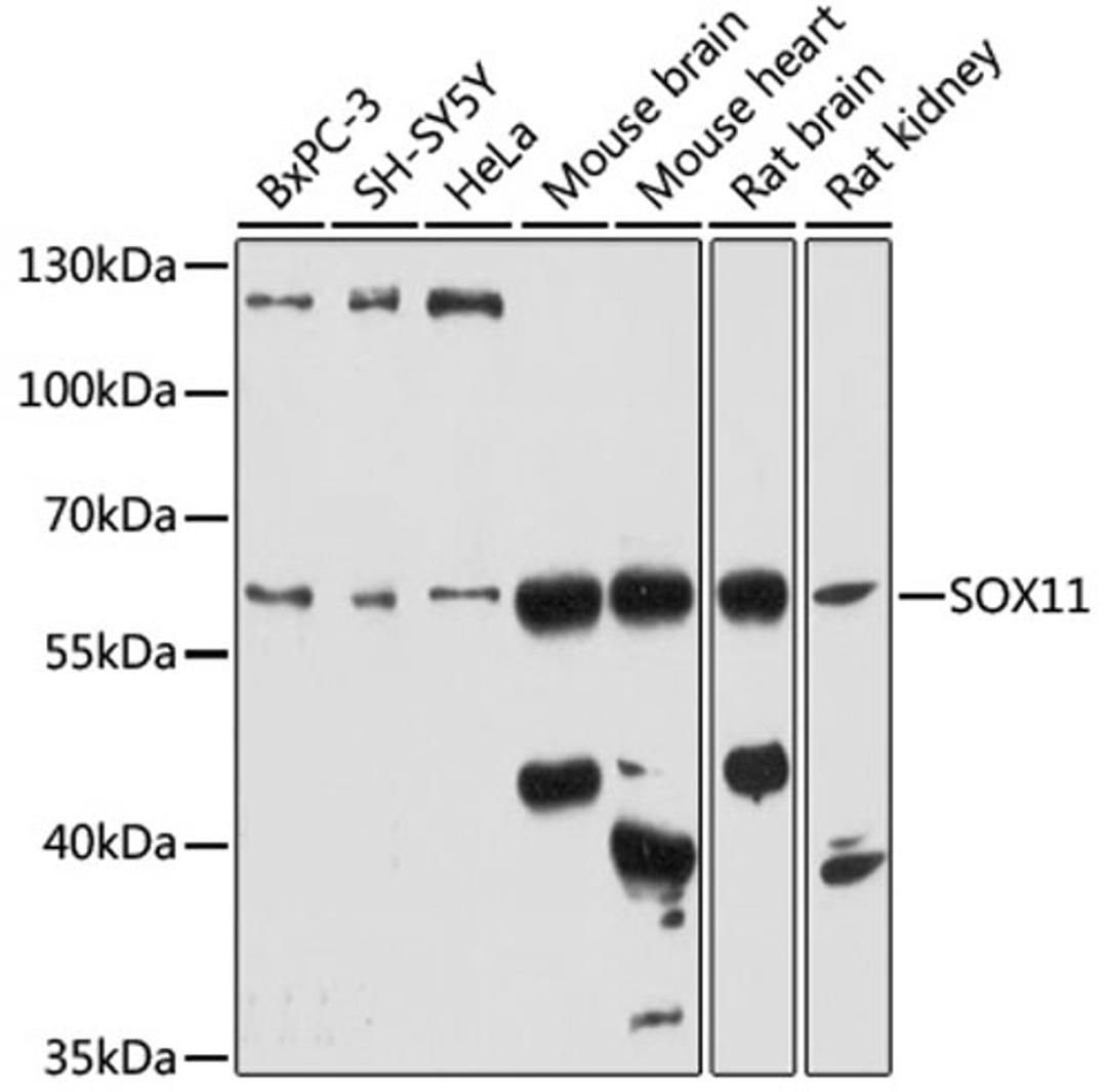 Western blot - SOX11 antibody (A17945)