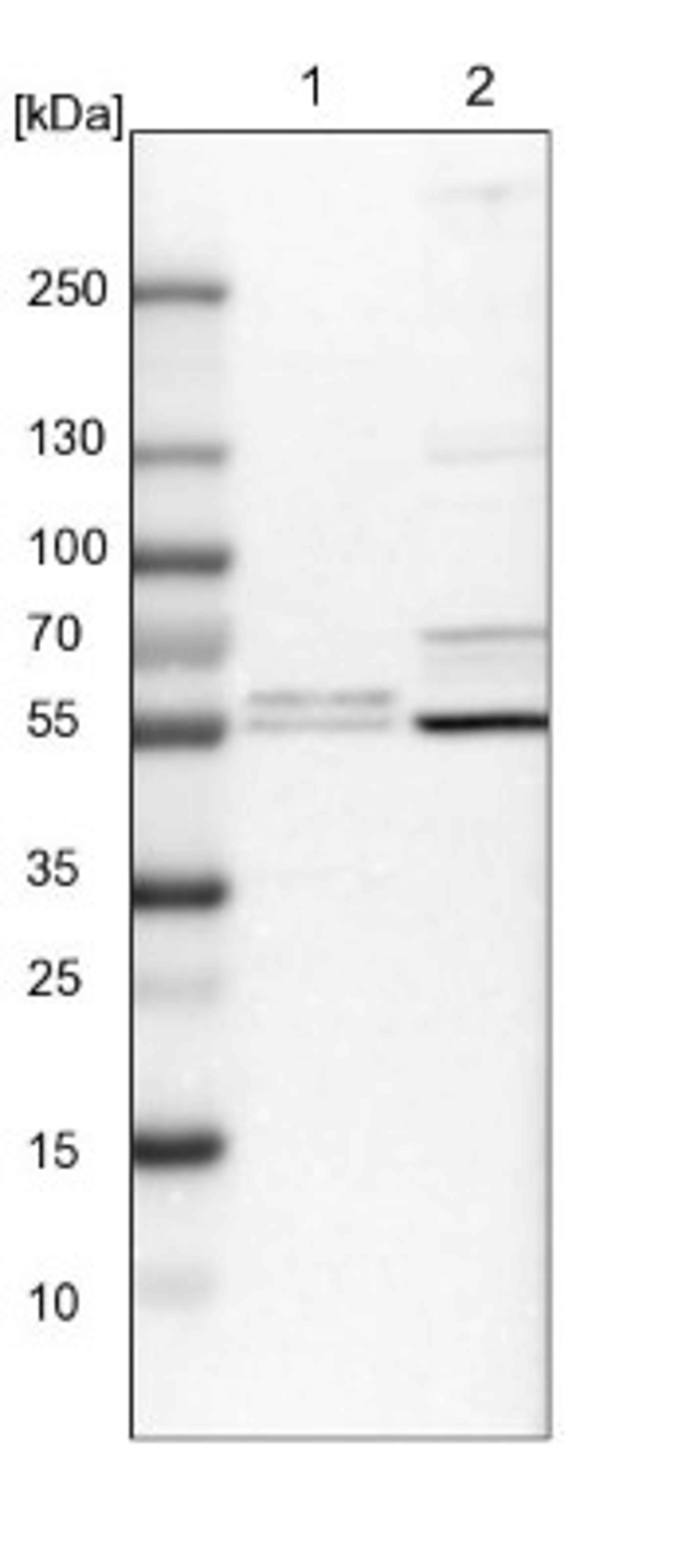 Western Blot: RSBN1L Antibody [NBP1-81903] - Lane 1: NIH-3T3 cell lysate (Mouse embryonic fibroblast cells)<br/>Lane 2: NBT-II cell lysate (Rat Wistar bladder tumour cells)