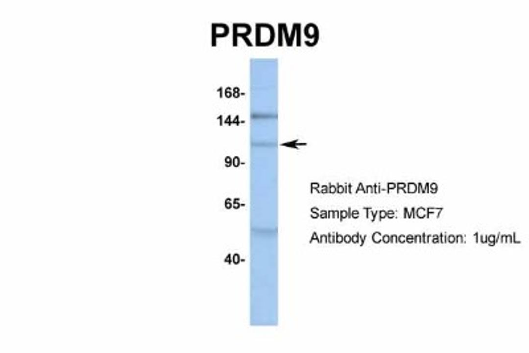 Western Blot: PRDM9 Antibody [NBP1-80118] - MCF7, Antibody Dilution: 1.0 ug/ml.