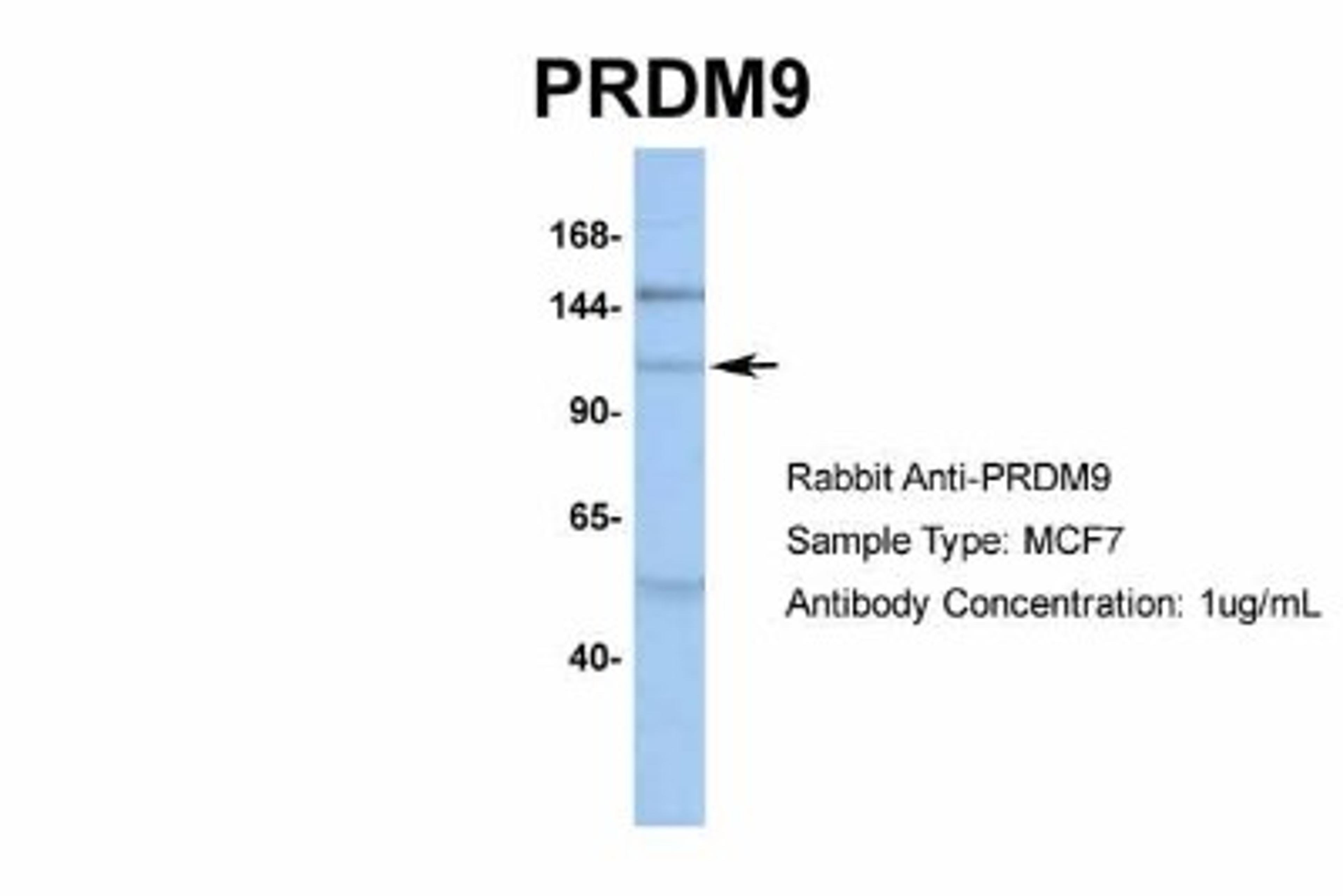 Western Blot: PRDM9 Antibody [NBP1-80118] - MCF7, Antibody Dilution: 1.0 ug/ml.