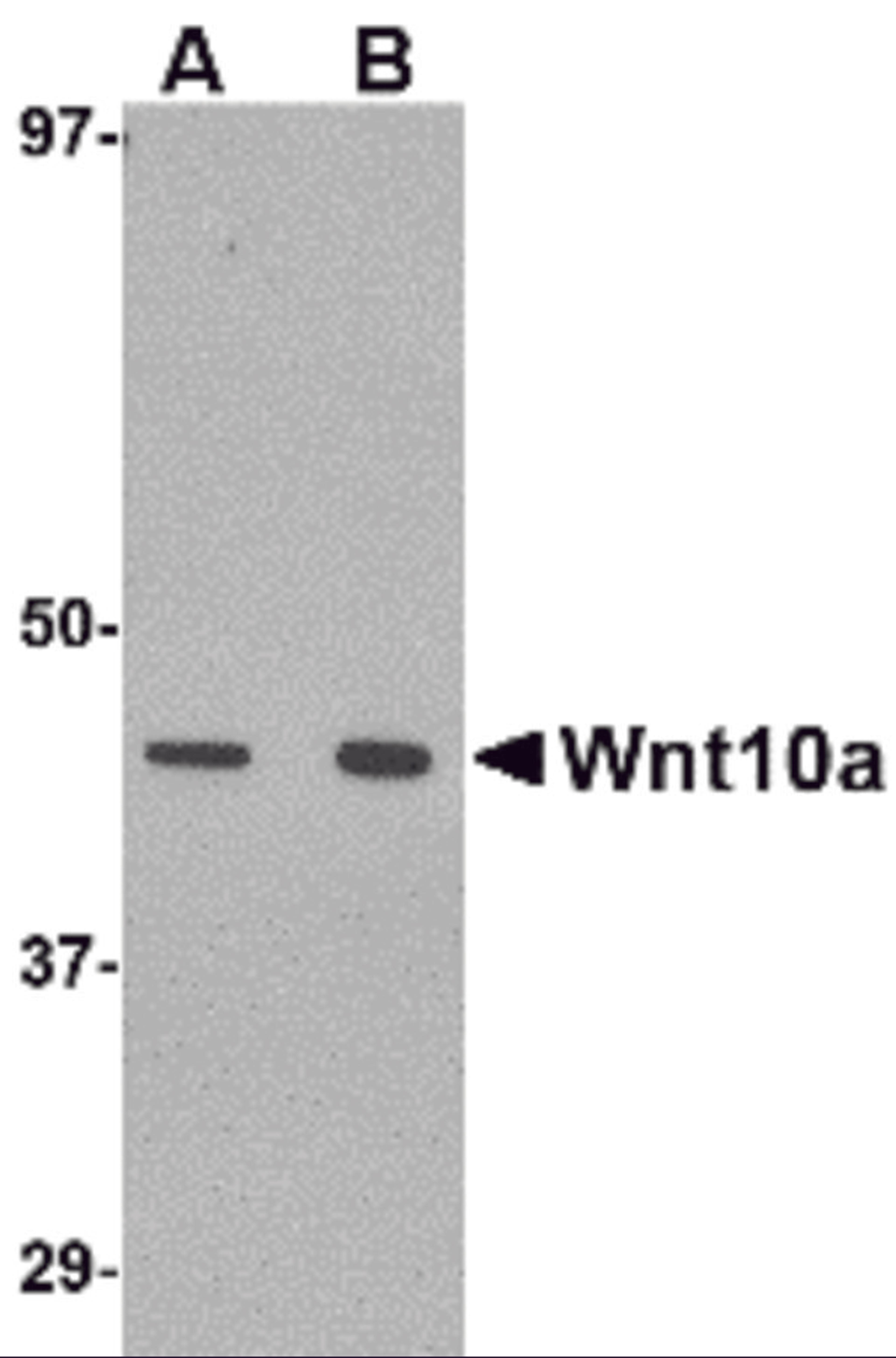 Western blot analysis of Wnt10a in RAW264.7 cell lysate with Wnt10a antibody at (A) 1 and (B) 2 &#956;g/mL.