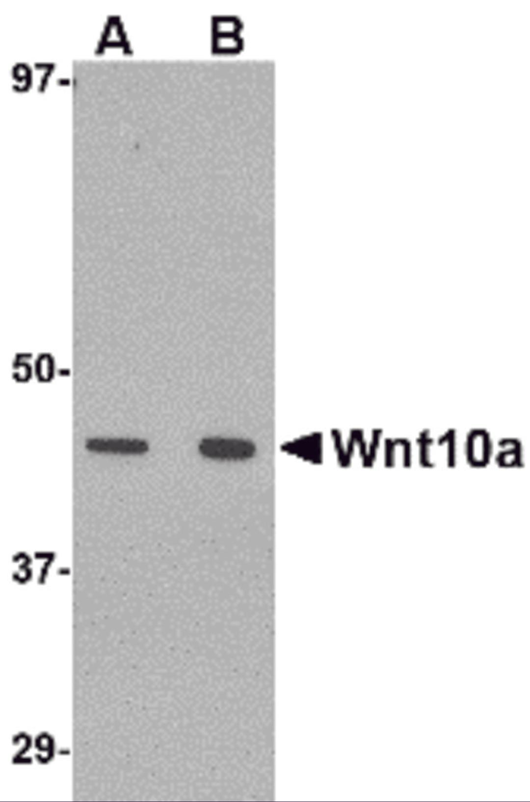Western blot analysis of Wnt10a in RAW264.7 cell lysate with Wnt10a antibody at (A) 1 and (B) 2 μg/mL.