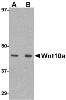 Western blot analysis of Wnt10a in RAW264.7 cell lysate with Wnt10a antibody at (A) 1 and (B) 2 μg/mL.