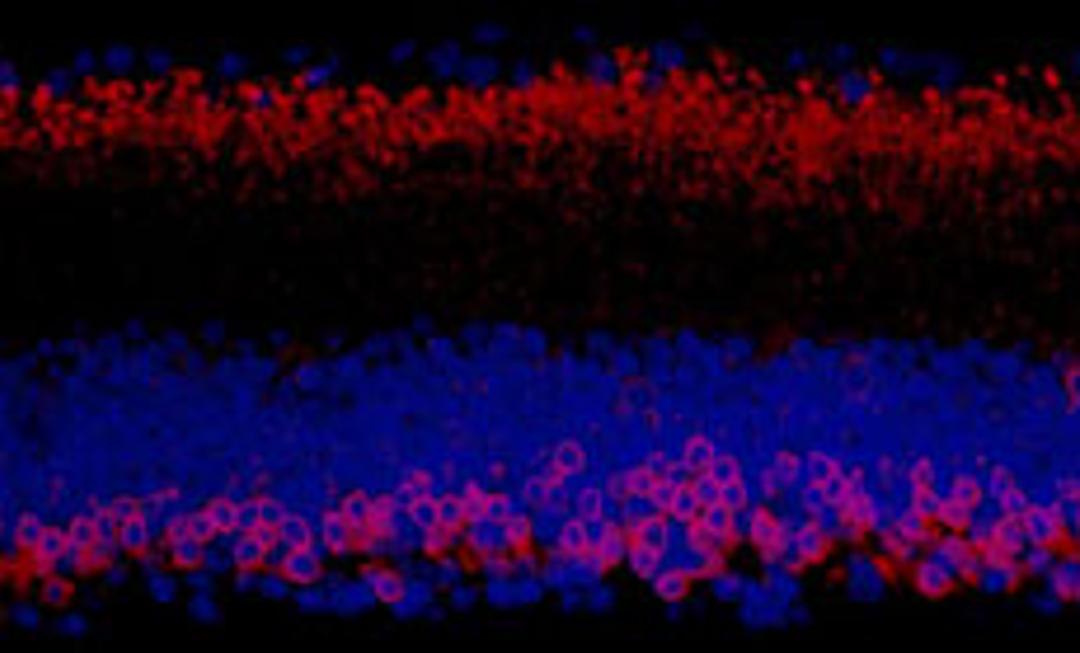 Detection of mouse PKC-alpha by immunohistochemistry.