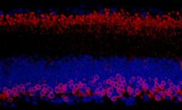 Detection of mouse PKC-alpha by immunohistochemistry.