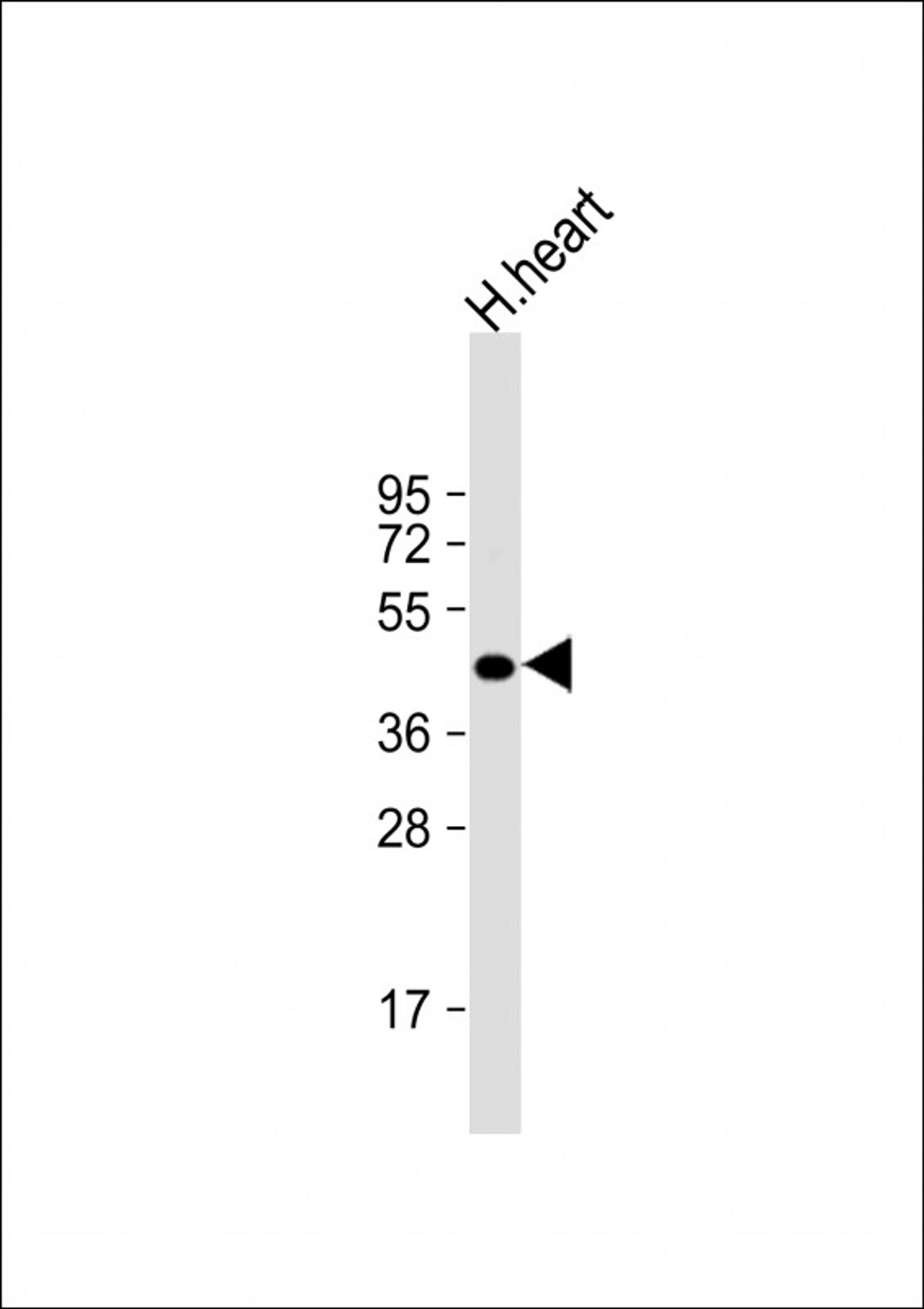 Western Blot at 1:2000 dilution + human heart lysate Lysates/proteins at 20 ug per lane.