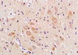 Immunohistochemical analysis of formalin-fixed paraffin embedded rat brain tissue using TMEM158 antibody (dilution at 1:200)