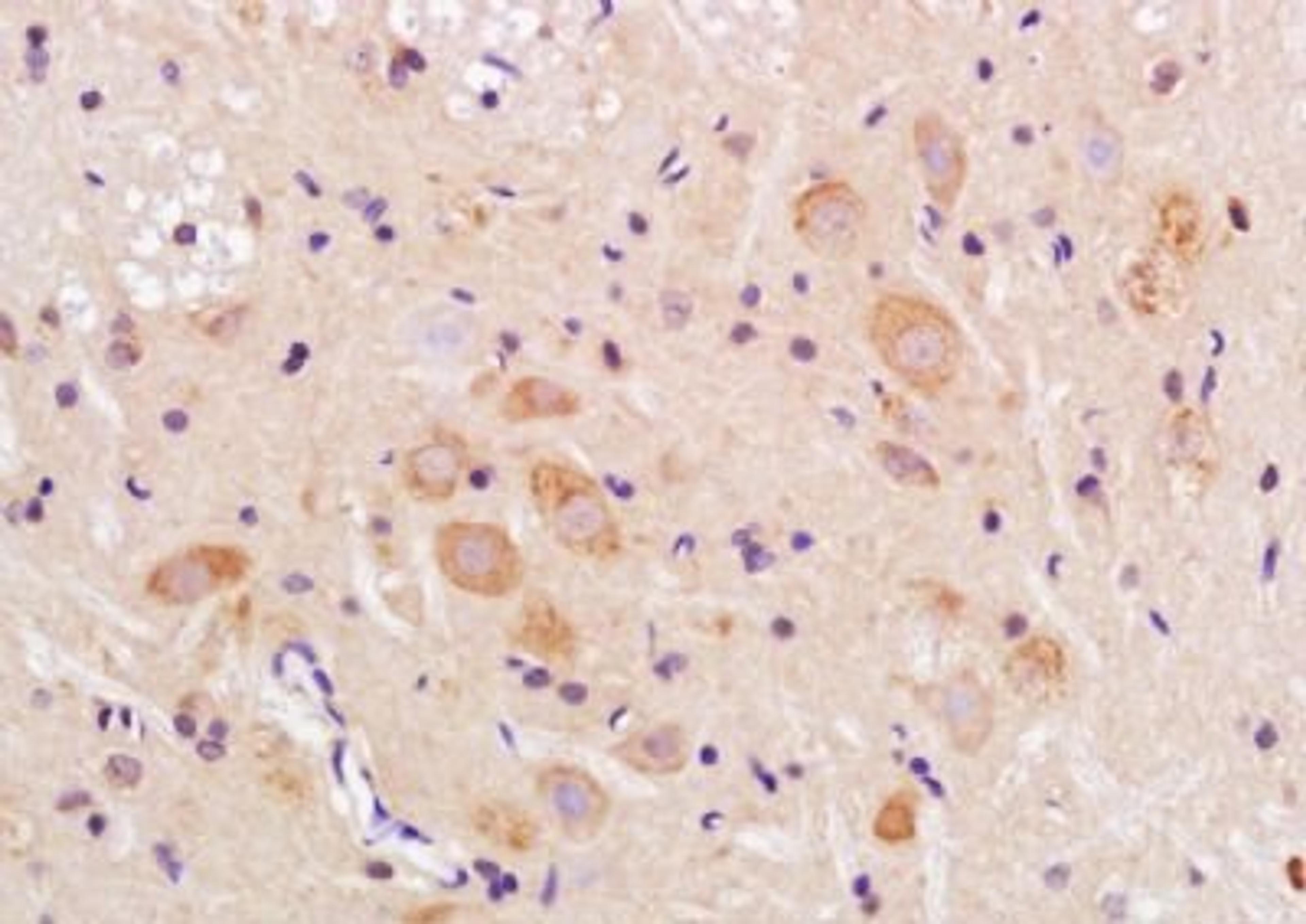 Immunohistochemical analysis of formalin-fixed paraffin embedded rat brain tissue using TMEM158 antibody (dilution at 1:200)