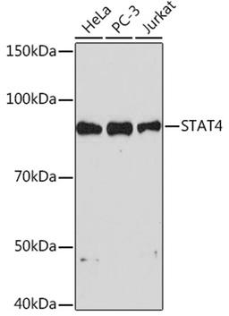 Western blot - STAT4 Rabbit mAb (A4523)