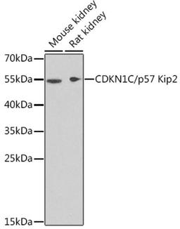 Western blot - CDKN1C/p57 Kip2 antibody (A2060)