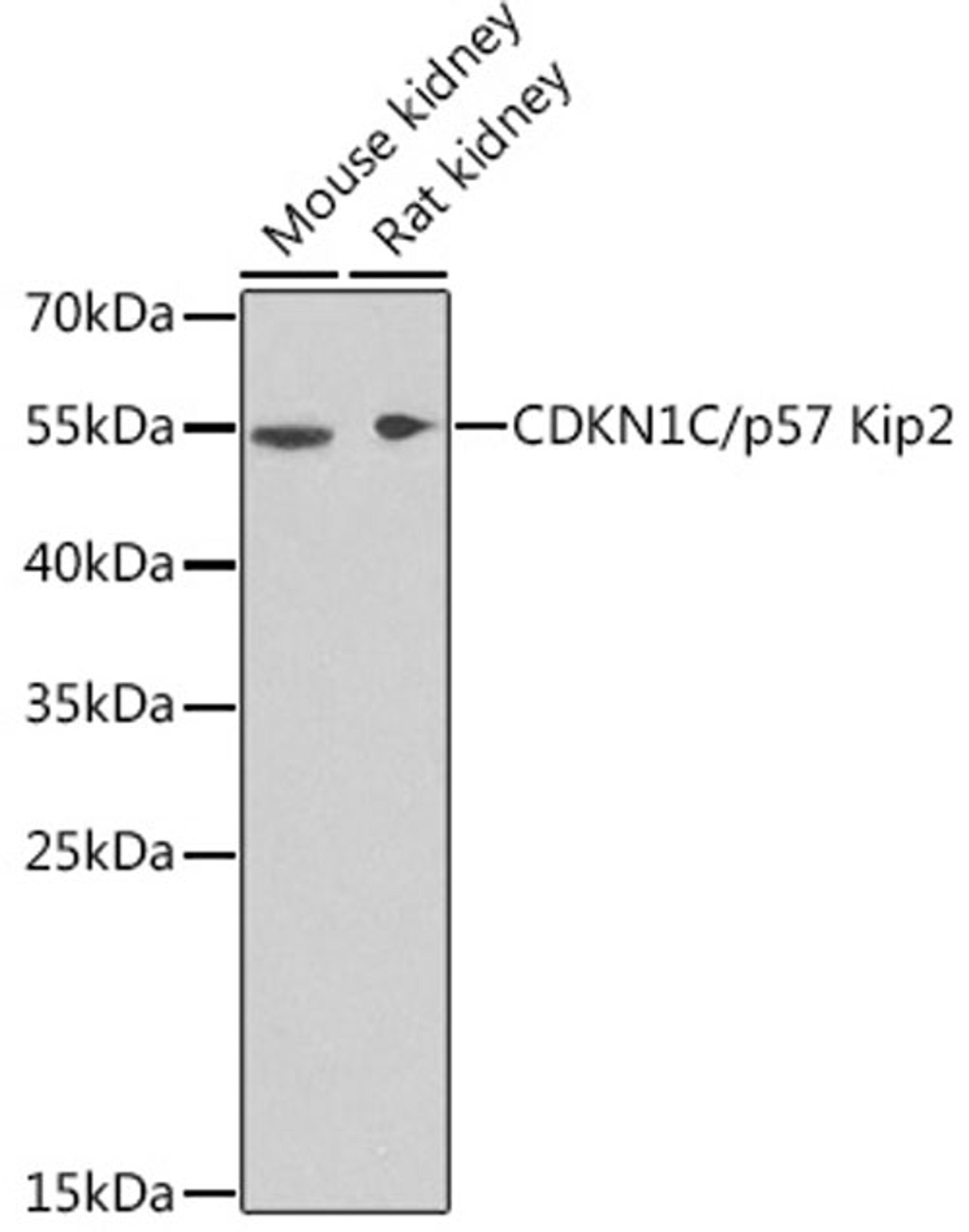 Western blot - CDKN1C/p57 Kip2 antibody (A2060)