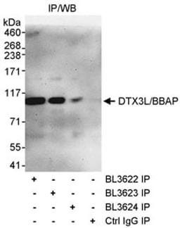 Detection of human DTX3L/BBAP by western blot of immunoprecipitates.