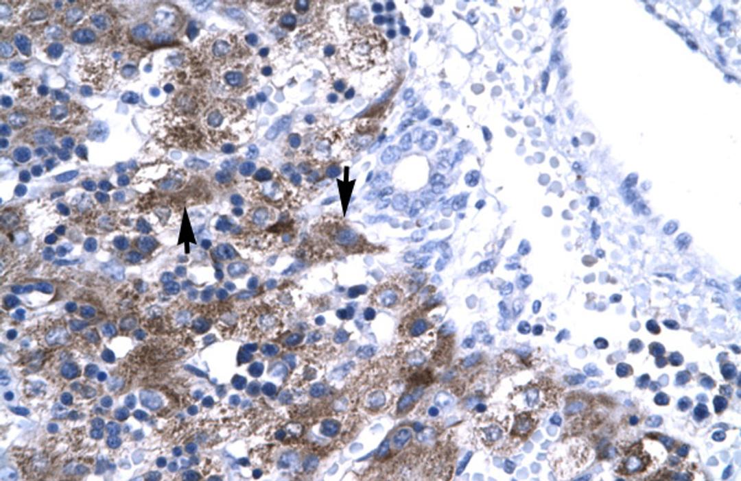 Antibody used in IHC on Human Liver cell lysates.