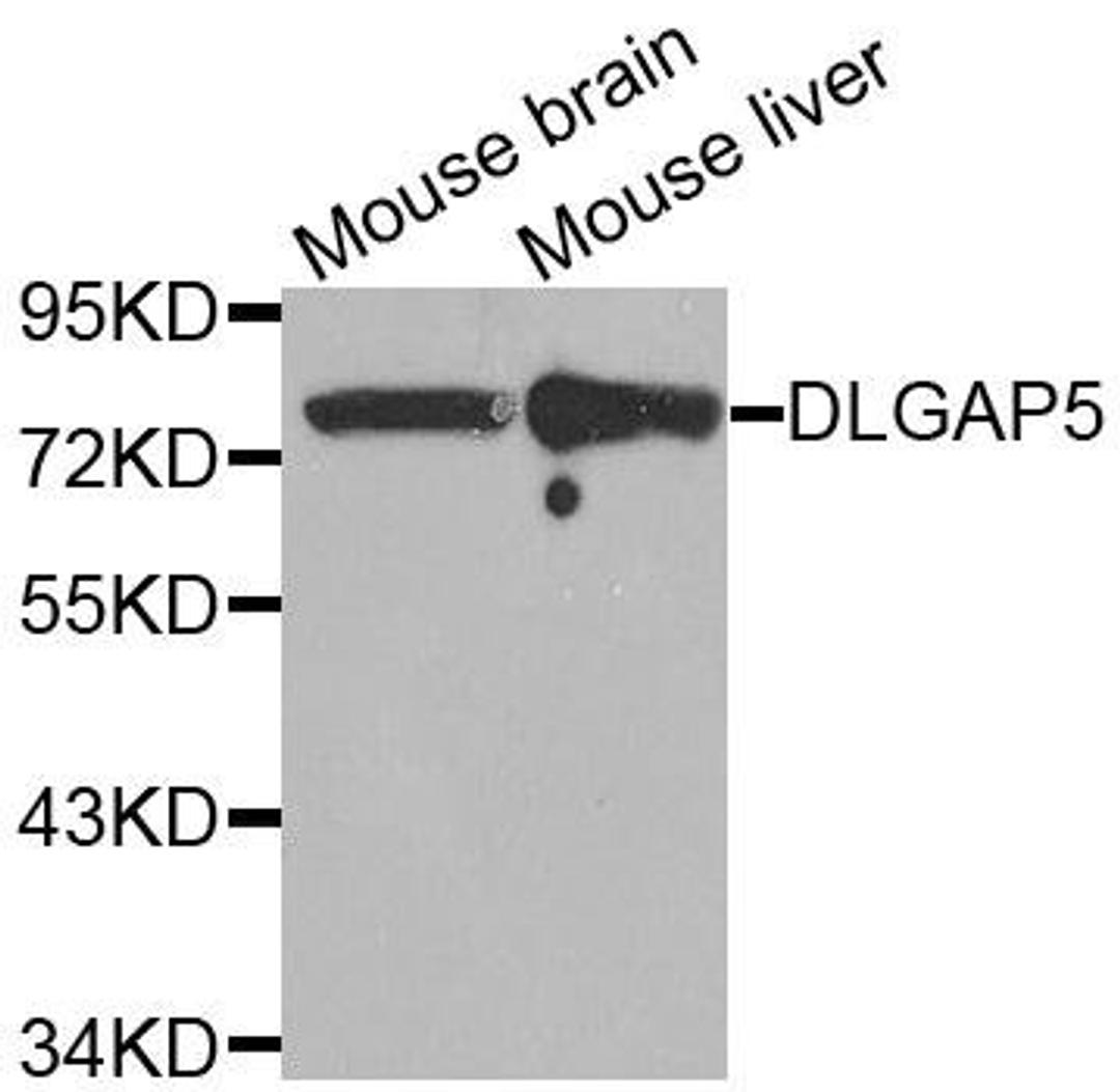 Western blot analysis of extracts of various tissues using DLGAP5 antibody