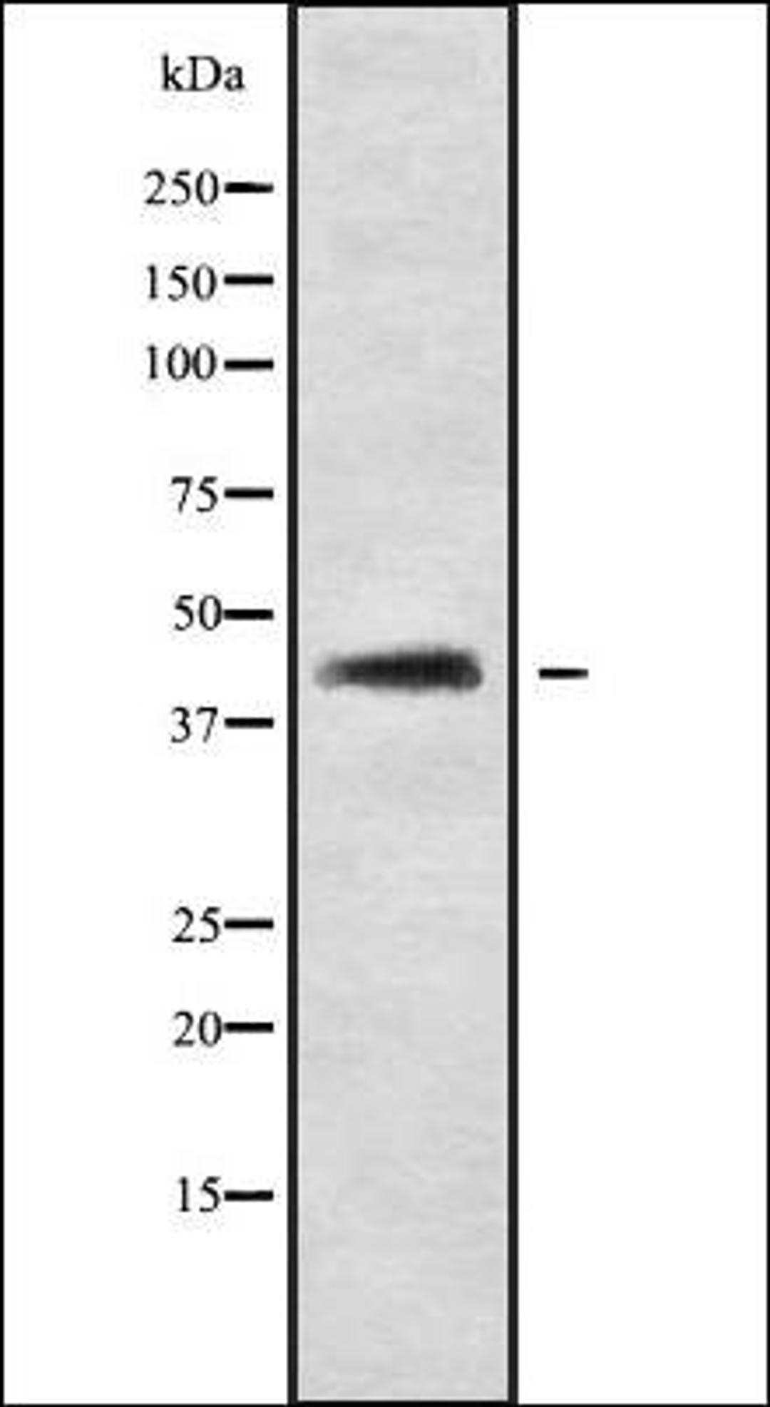 Western blot analysis of LOVO whole cell lysates using SP5 antibody