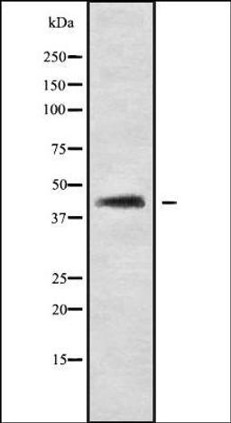 Western blot analysis of LOVO whole cell lysates using SP5 antibody