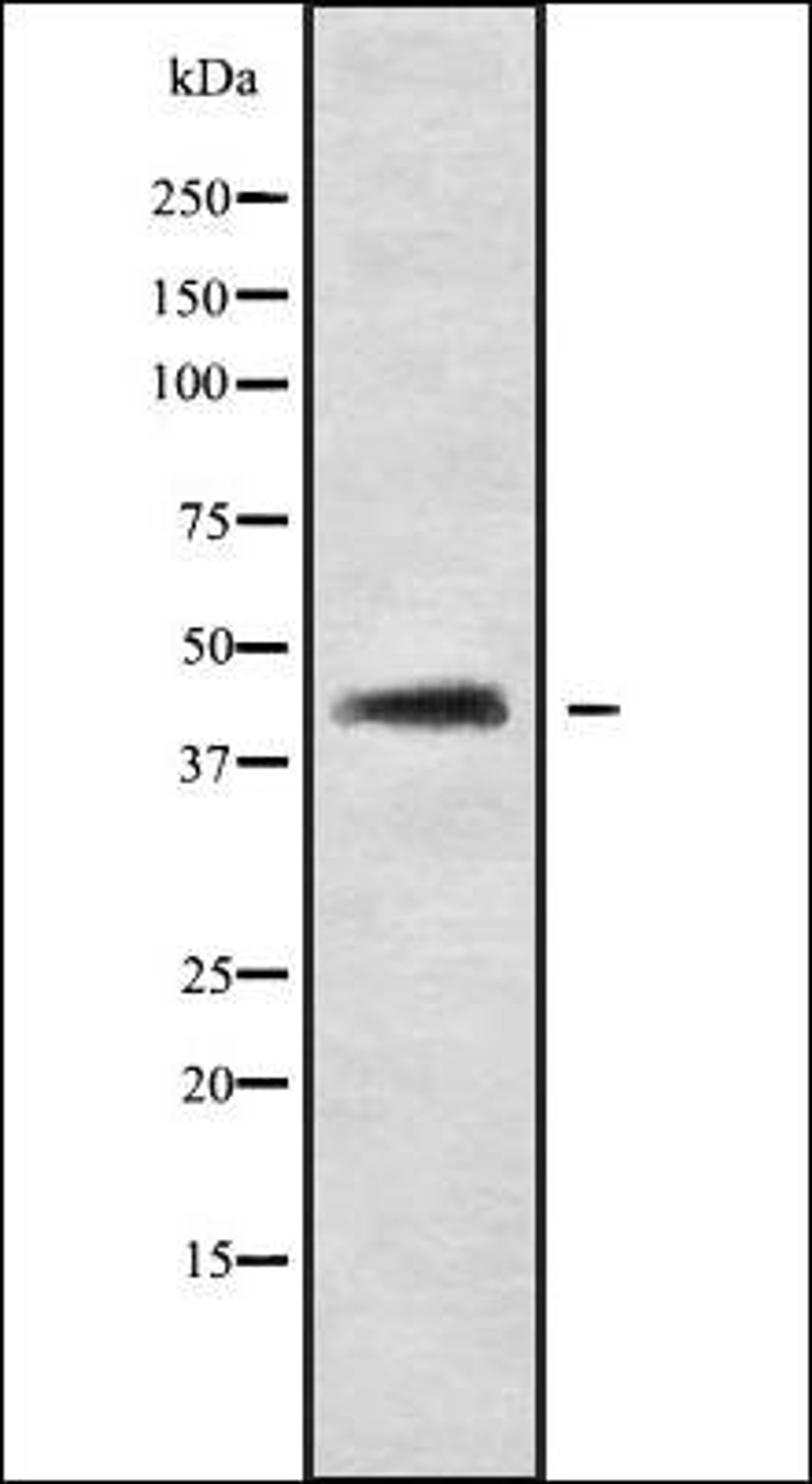 Western blot analysis of LOVO whole cell lysates using SP5 antibody