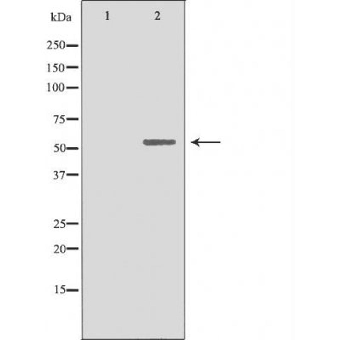 Western blot analysis of 293 cells using 19A1 (Cytochrome P450) antibody