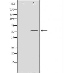 Western blot analysis of 293 cells using 19A1 (Cytochrome P450) antibody