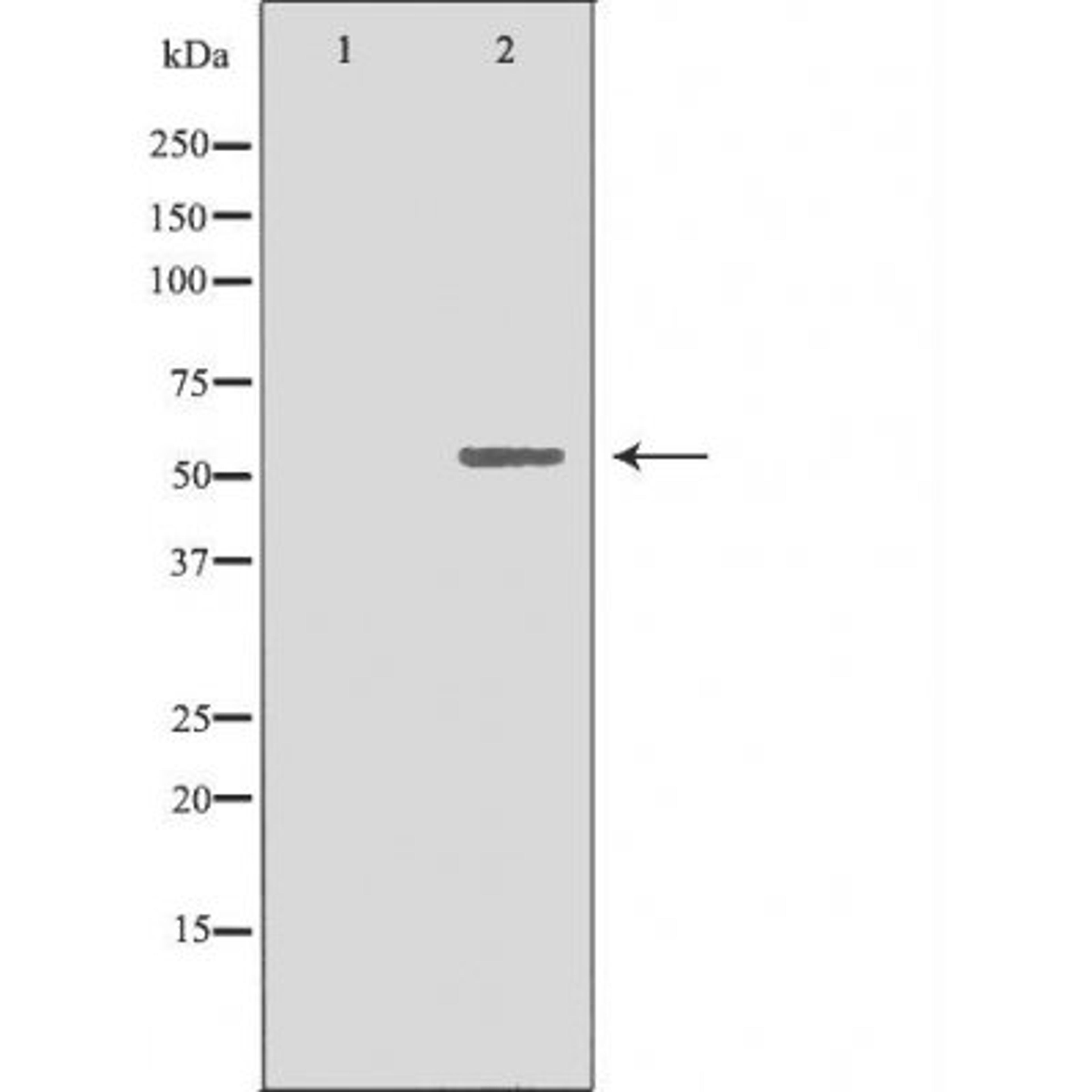 Western blot analysis of 293 cells using 19A1 (Cytochrome P450) antibody