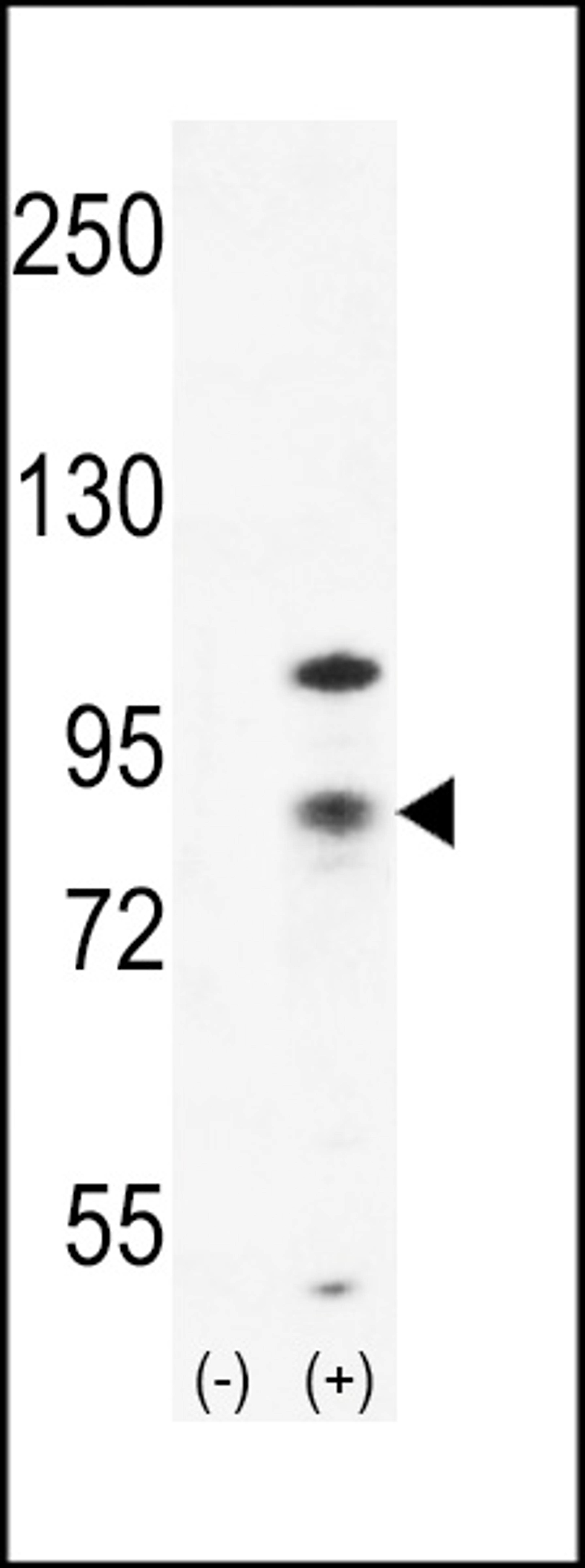 Western blot analysis of CTNB1 using rabbit polyclonal CTNB1 Antibody using 293 cell lysates (2 ug/lane) either nontransfected (Lane 1) or transiently transfected (Lane 2) with the CTNB1 gene.