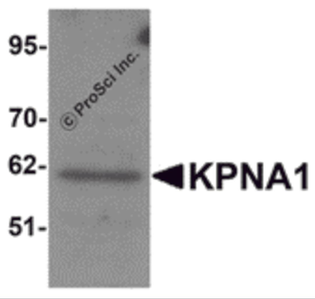Western blot analysis of KPNA1 in Hela cell lysate with KPNA1 antibody at 1μg/mL.