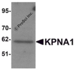 Western blot analysis of KPNA1 in Hela cell lysate with KPNA1 antibody at 1μg/mL.