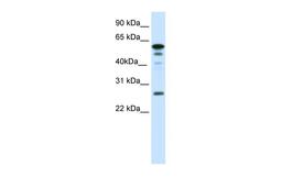 Antibody used in WB on Mouse SP2/0 at 0.0625 ug/ml.