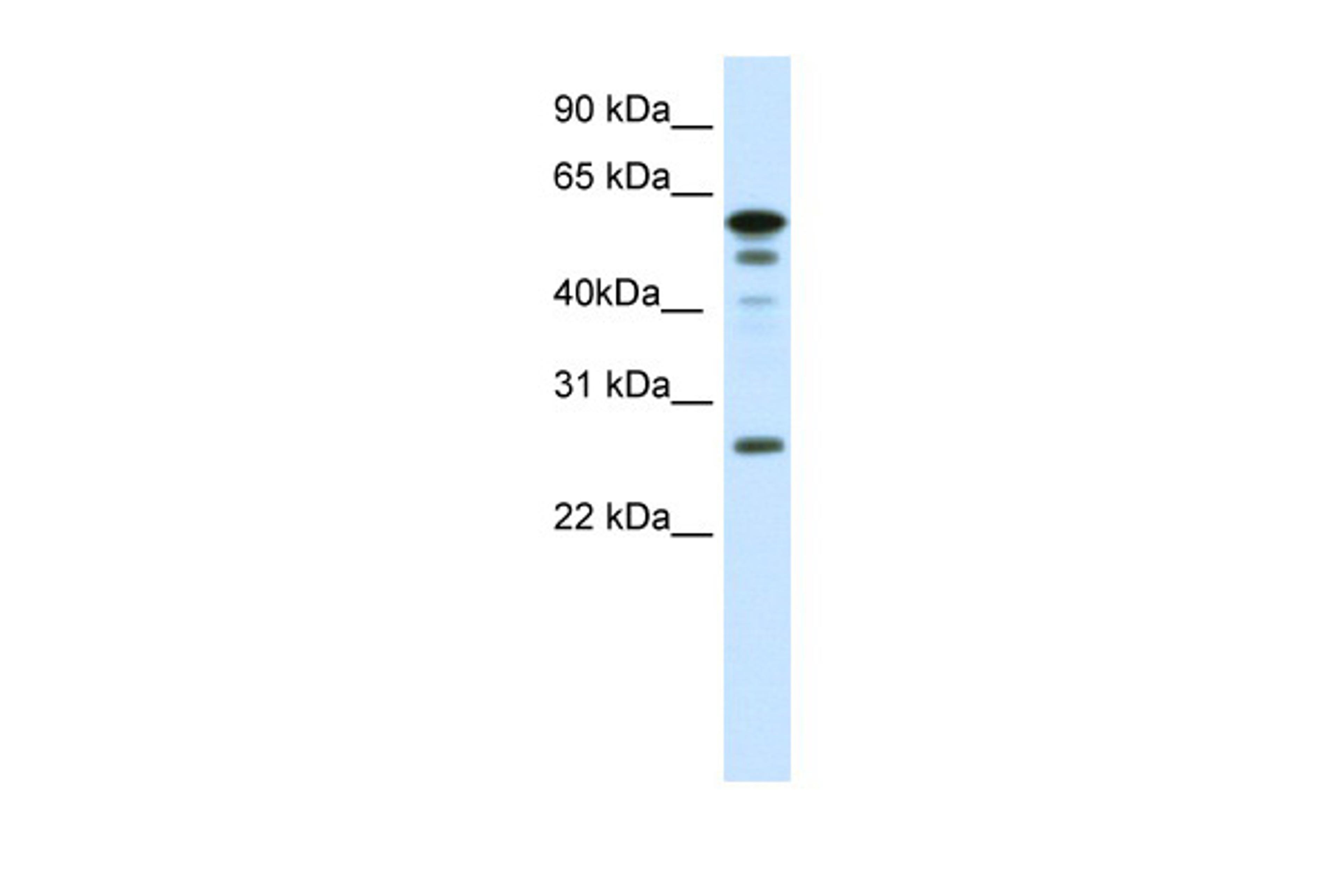 Antibody used in WB on Mouse SP2/0 at 0.0625 ug/ml.