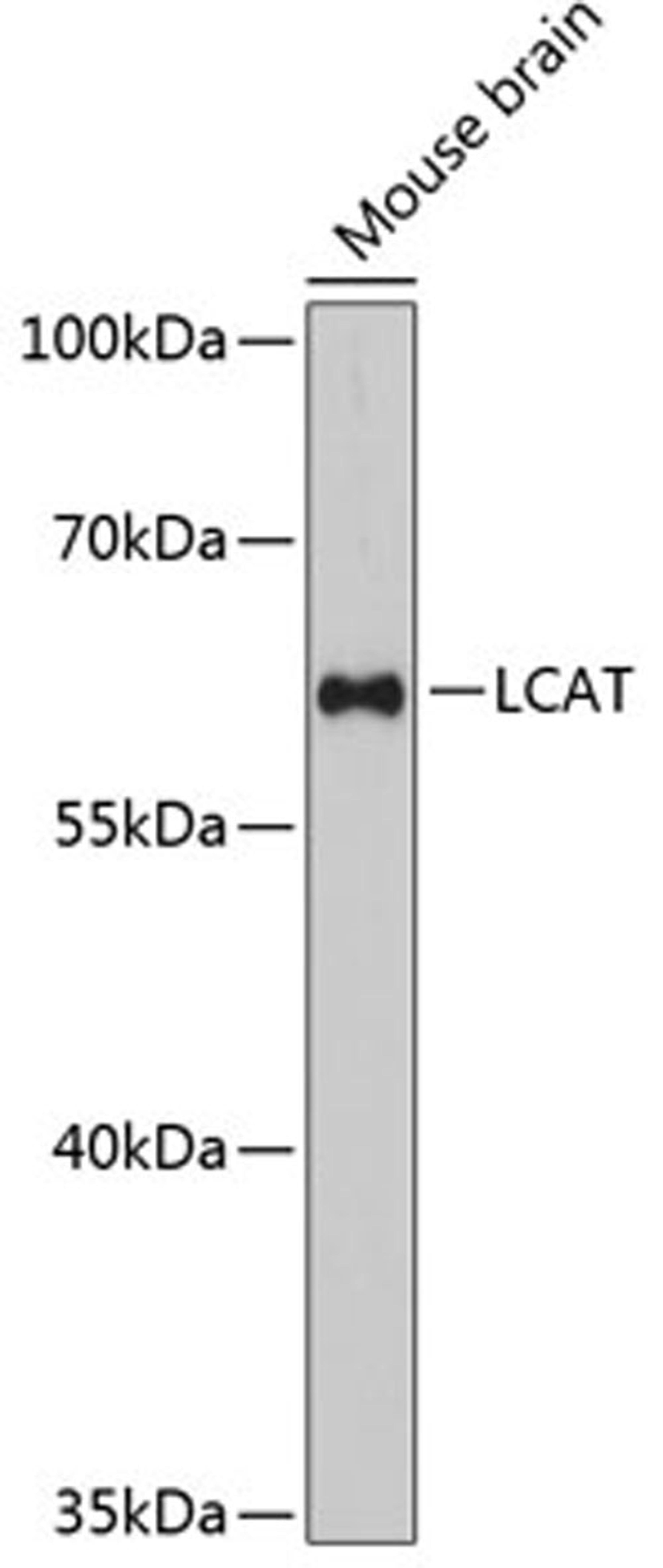 Western blot - LCAT antibody (A11741)