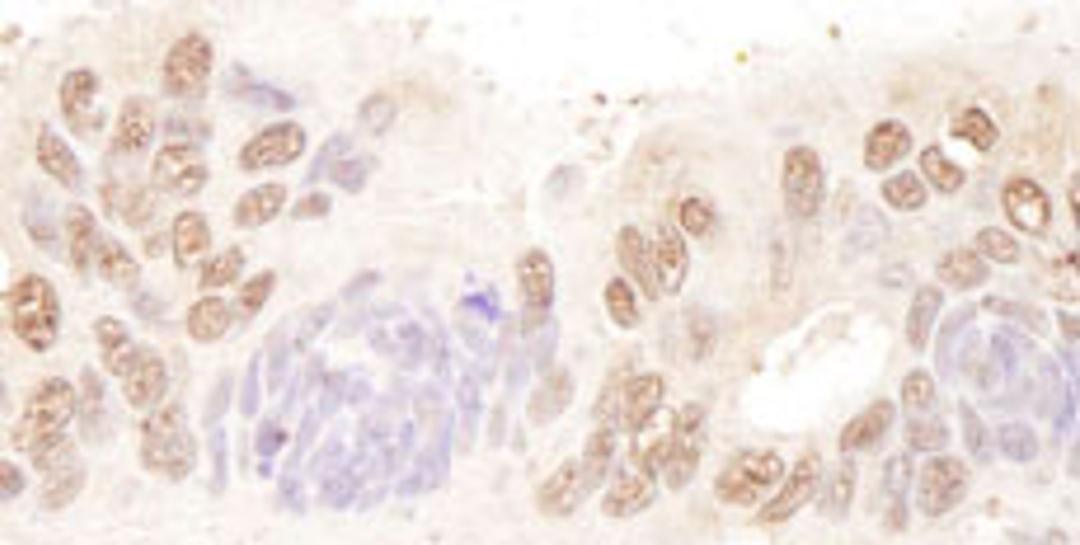 Detection of human BTF by immunohistochemistry.