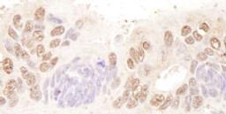 Detection of human BTF by immunohistochemistry.