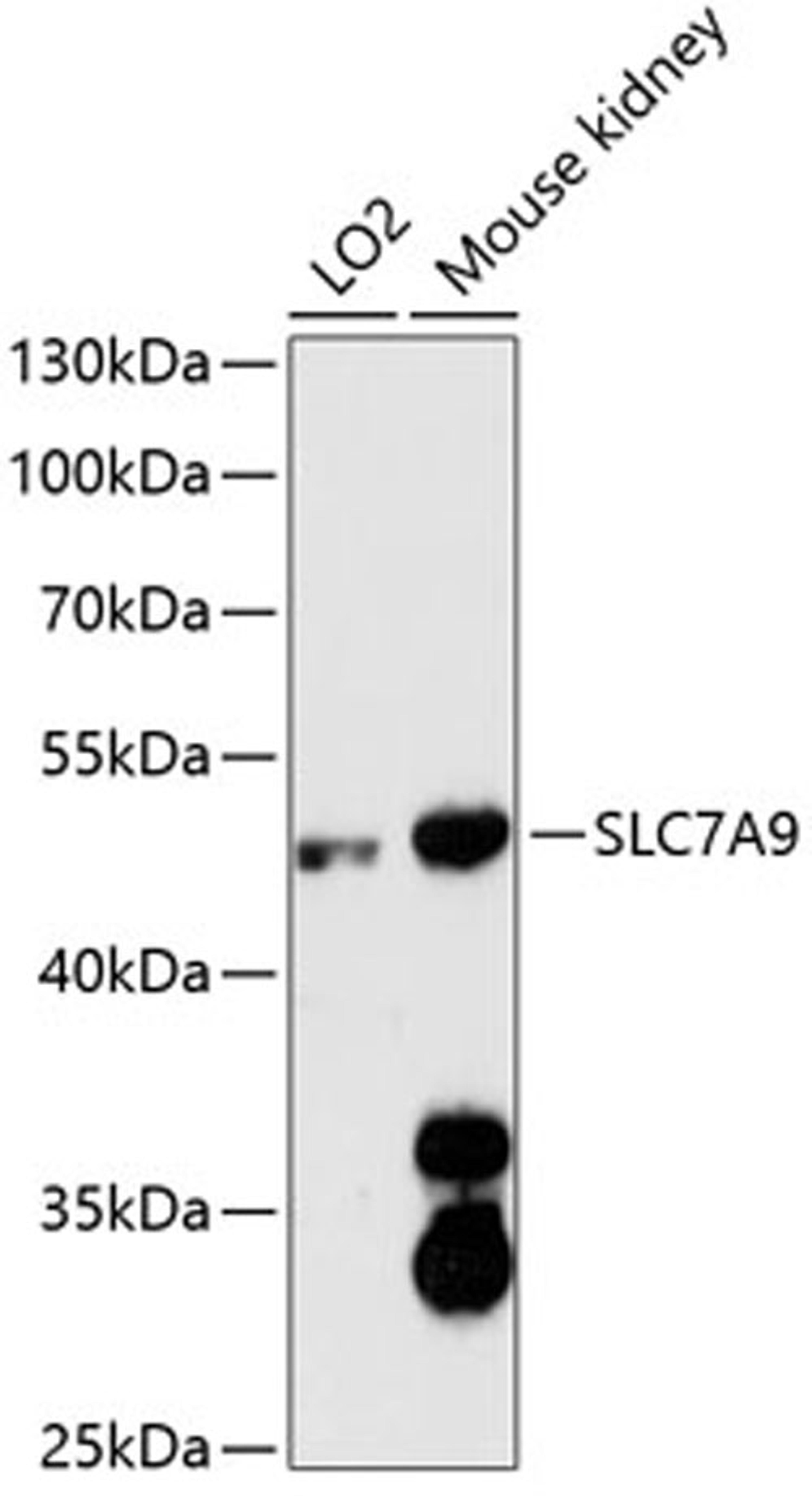 Western blot - SLC7A9 antibody (A12848)