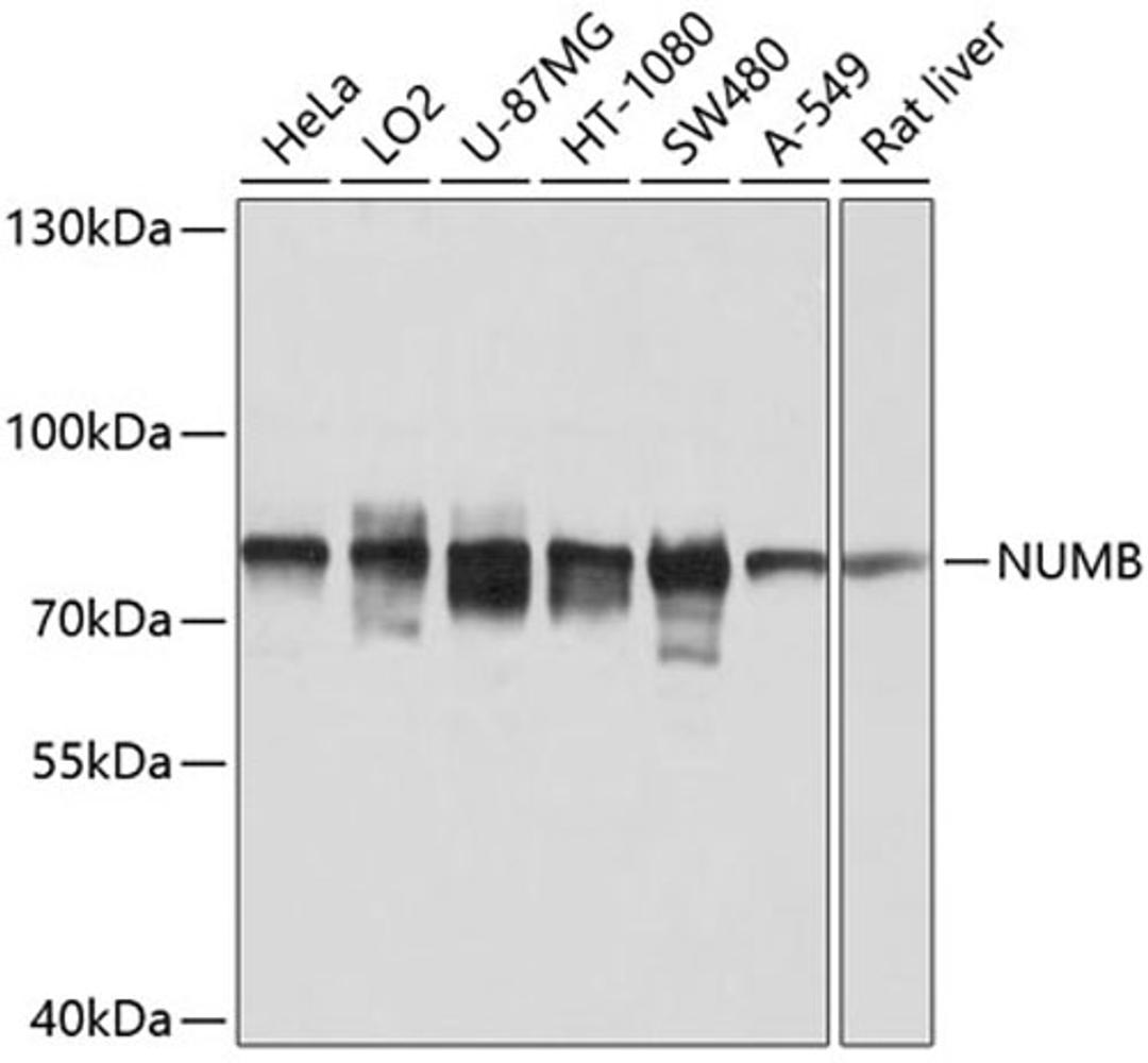 Western blot - NUMB antibody (A9352)