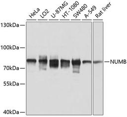 Western blot - NUMB antibody (A9352)