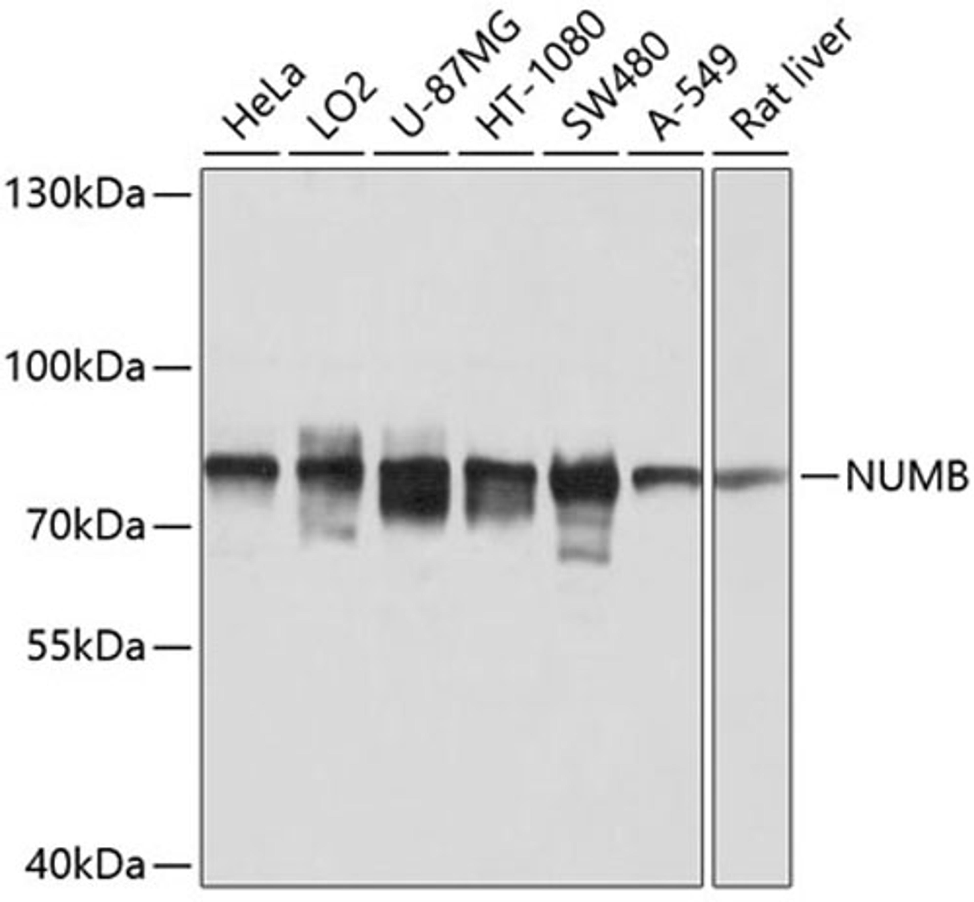 Western blot - NUMB antibody (A9352)