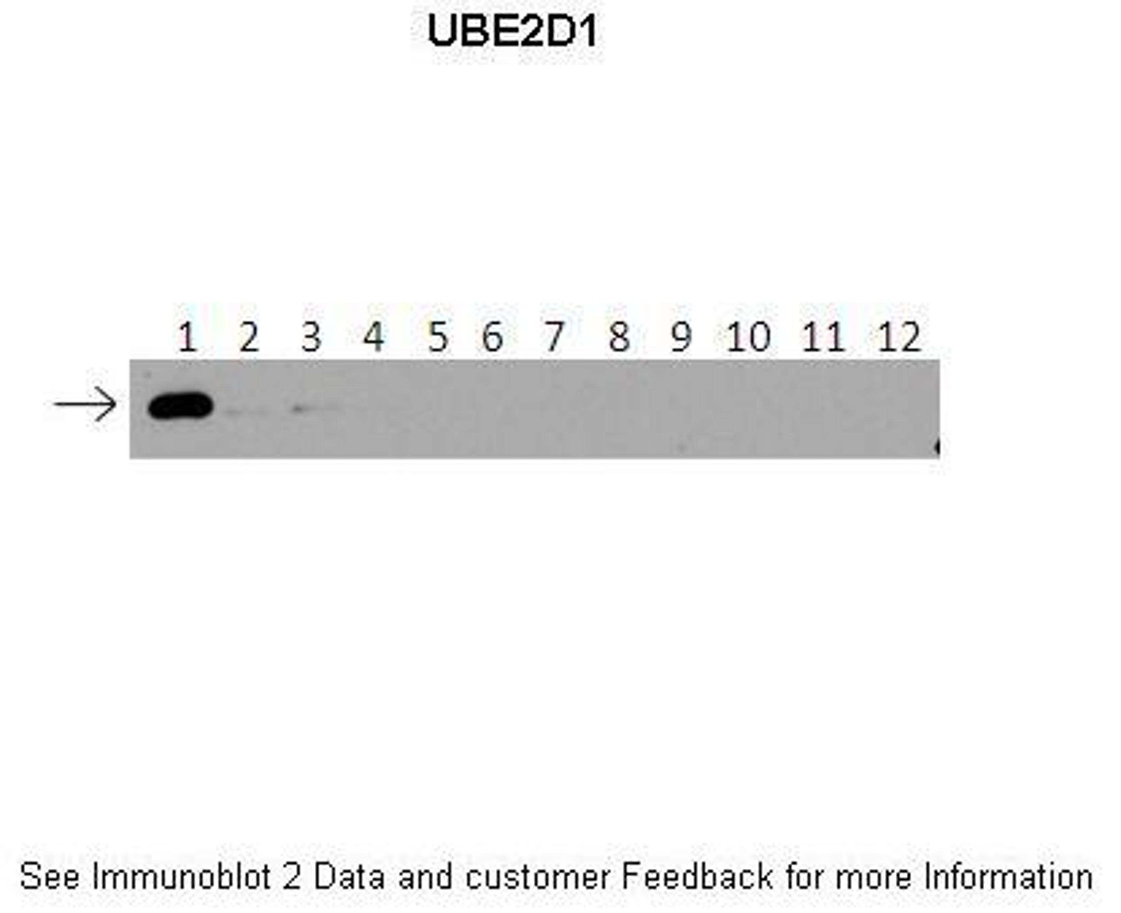 Antibody used in WB on recombinant protein at: 1:500 (Lanes: 1: 40ng HIS-UBE2D1 protein, 2: 40ng HIS-UBE2D2 protein, 3: 40ng HIS-UBE2D3 proteinm, 4: 40ng HIS-UBE2D4 protein, 5: 40ng HIS-UBE2E1 protein, 6: 40ng HIS-UBE2E2 protein, 7: 40ng HIS-UBE2E3 protei