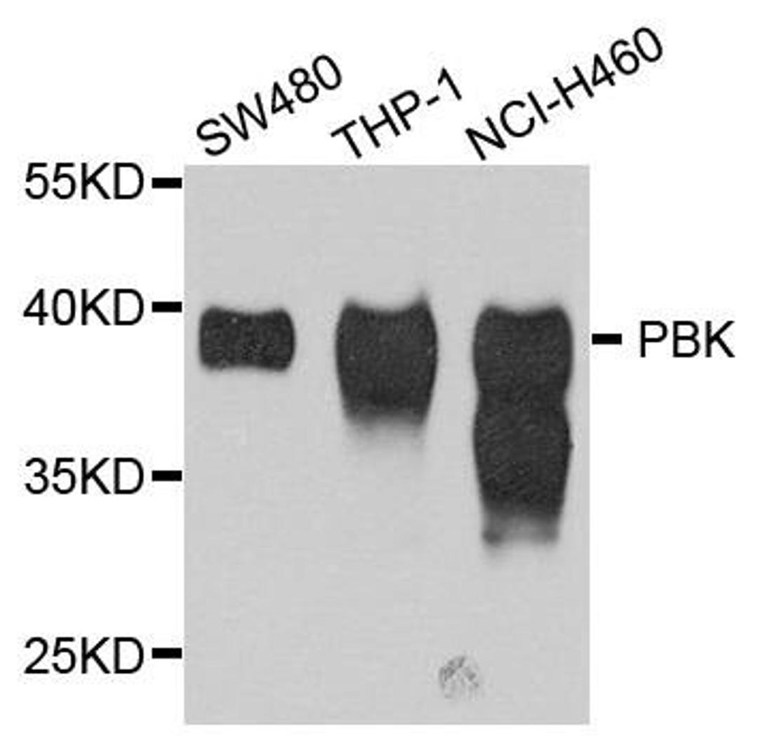 Western blot analysis of extract of various cells using SPK antibody