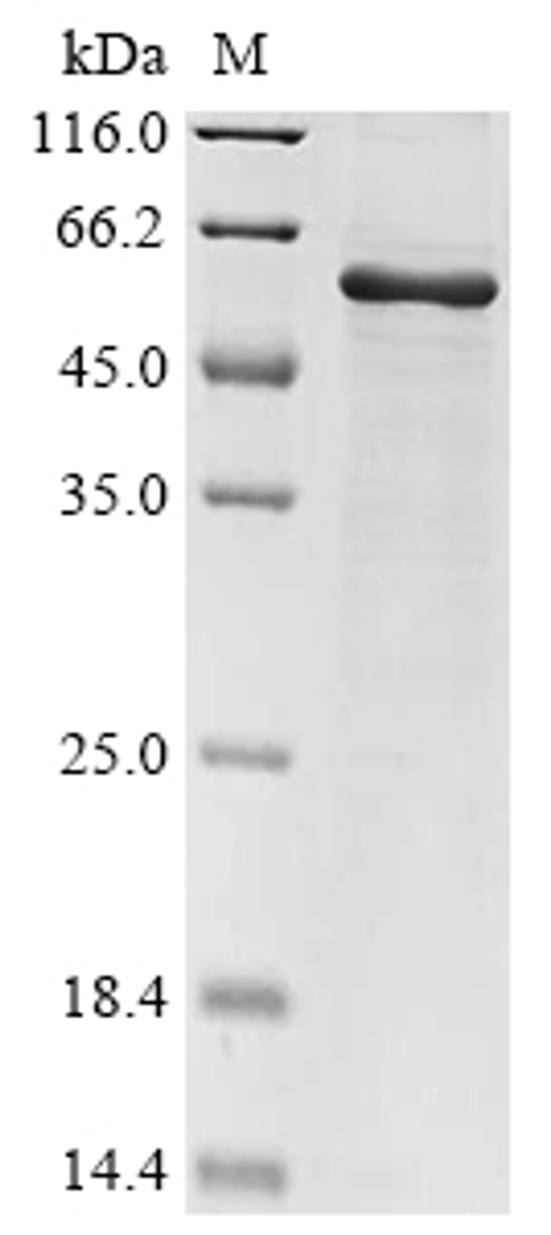 (Tris-Glycine gel) Discontinuous SDS-PAGE (reduced) with 5% enrichment gel and 15% separation gel.