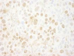 Detection of mouse BMI1 by immunohistochemistry.