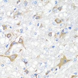 Immunohistochemistry - IL22 antibody (A6216)
