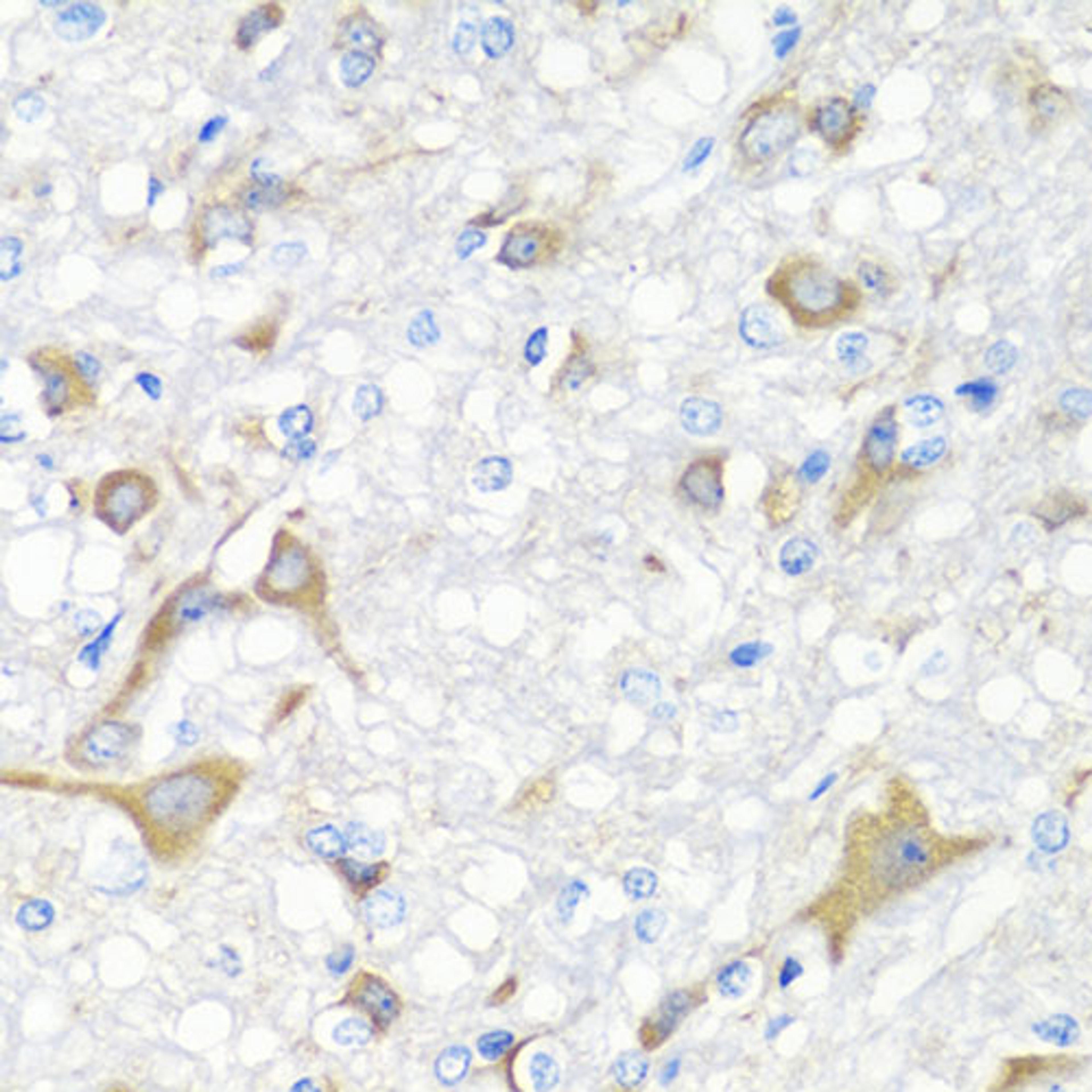 Immunohistochemistry - IL22 antibody (A6216)