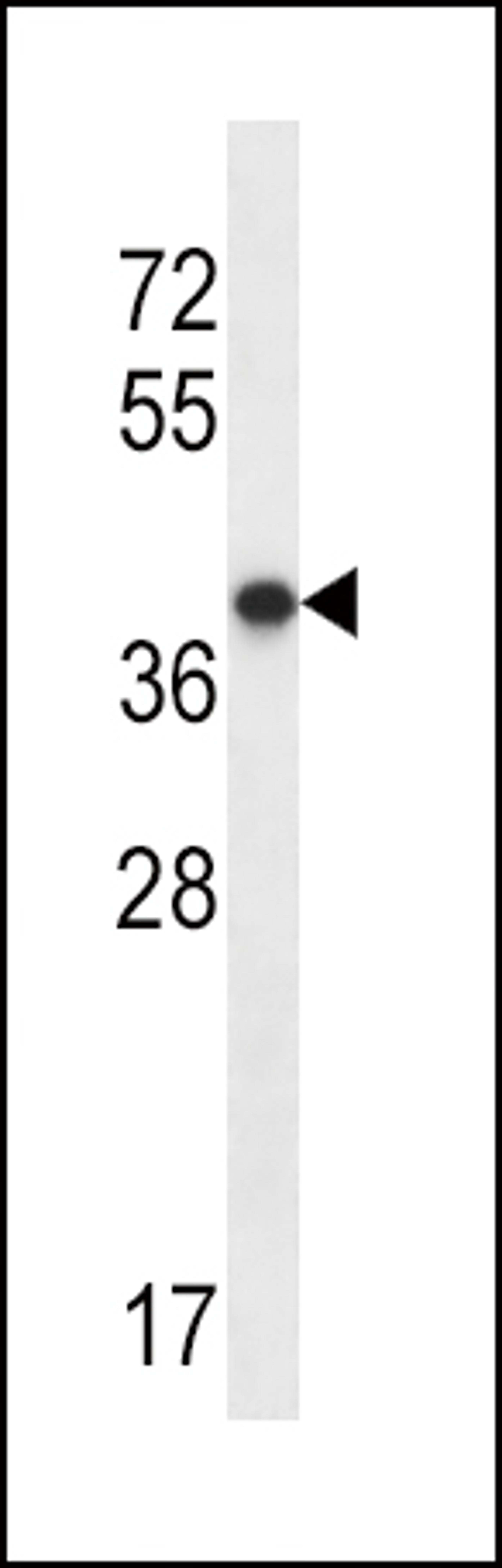 Western blot analysis in NCI-H292 cell line lysates (35ug/lane).