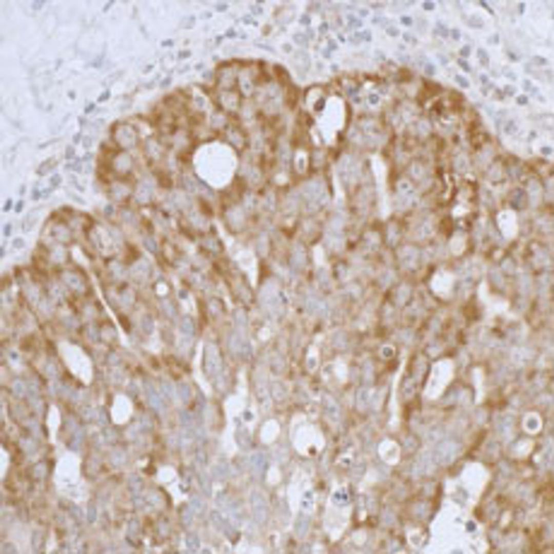 Detection of human Peroxiredoxin-3 by immunohistochemistry.