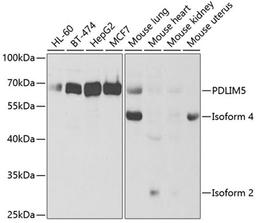 Western blot - PDLIM5 antibody (A5720)