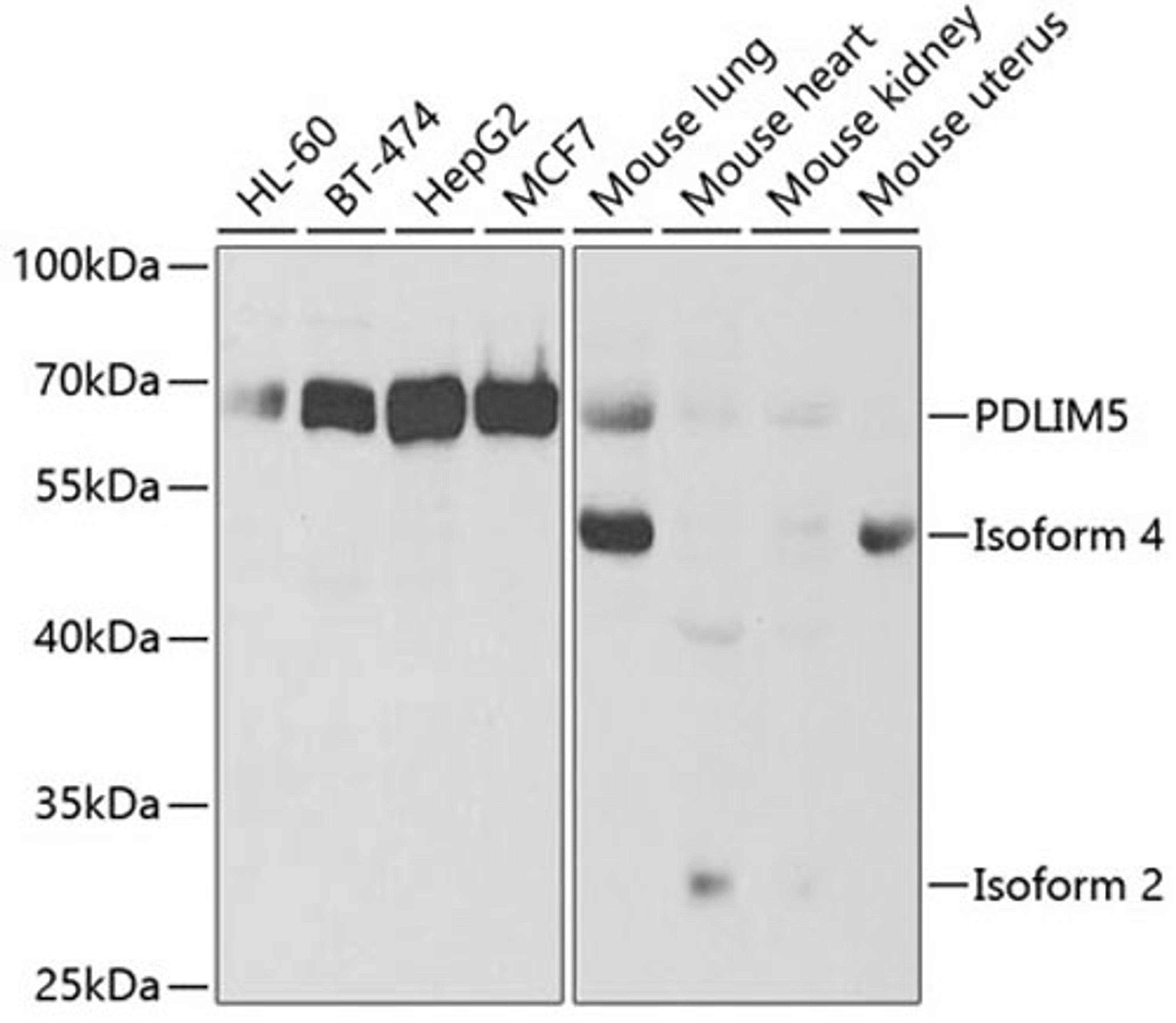 Western blot - PDLIM5 antibody (A5720)