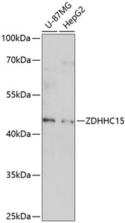 Western blot - ZDHHC15 antibody (A14454)